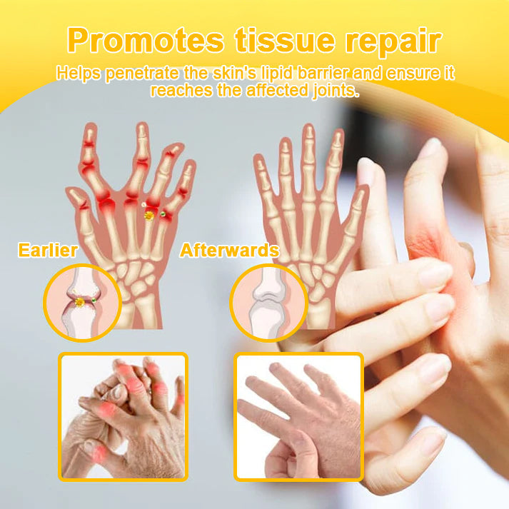 Aeehfeng® Only 8 PCS left! We are offering you an additional 30% OFF! Your orthopedic surgeon recommends that you use 4-5 consecutive PCS to restore your joints to health! If you miss this opportunity, you'll have to wait until next year!
