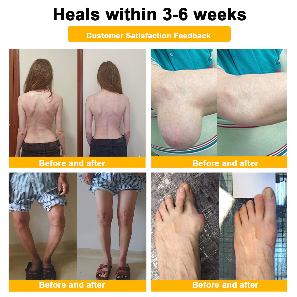 Aeehfeng® Only 8 PCS left! We are offering you an additional 30% OFF! Your orthopedic surgeon recommends that you use 4-5 consecutive PCS to restore your joints to health! If you miss this opportunity, you'll have to wait until next year!
