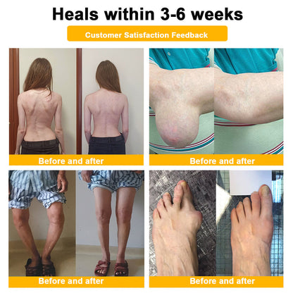 Aeehfeng® Only 8 PCS left! We are offering you an additional 30% OFF! Your orthopedic surgeon recommends that you use 4-5 consecutive PCS to restore your joints to health! If you miss this opportunity, you'll have to wait until next year!