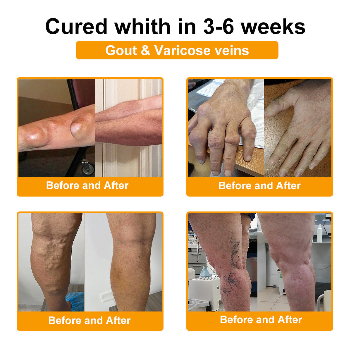 Aeehfeng® Only 8 PCS left! We are offering you an additional 30% OFF! Your orthopedic surgeon recommends that you use 4-5 consecutive PCS to restore your joints to health! If you miss this opportunity, you'll have to wait until next year!