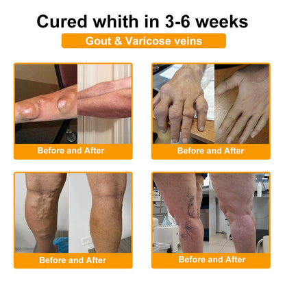 Aeehfeng® Only 8 PCS left! We are offering you an additional 30% OFF! Your orthopedic surgeon recommends that you use 4-5 consecutive PCS to restore your joints to health! If you miss this opportunity, you'll have to wait until next year!