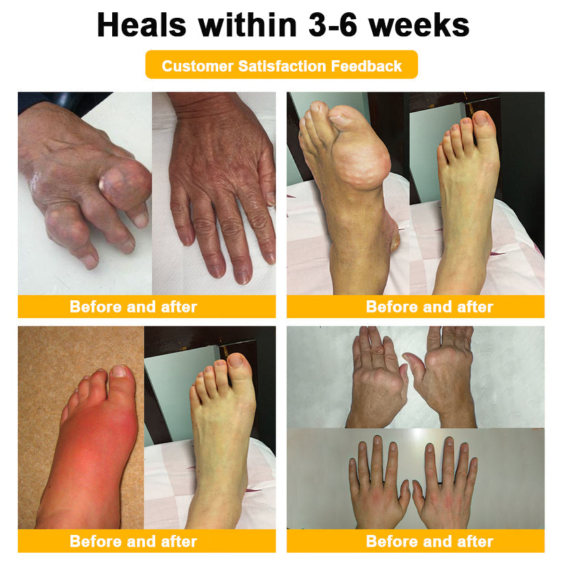 Aeehfeng® Only 8 PCS left! We are offering you an additional 30% OFF! Your orthopedic surgeon recommends that you use 4-5 consecutive PCS to restore your joints to health! If you miss this opportunity, you'll have to wait until next year!