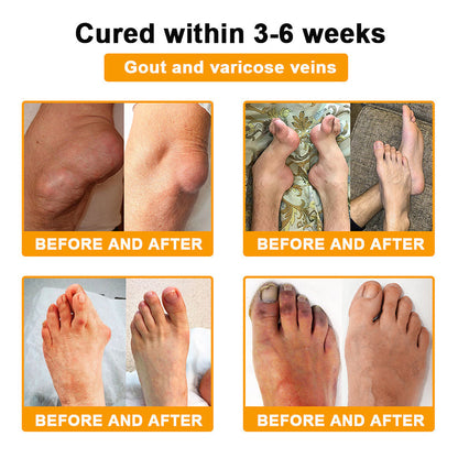 Aeehfeng® Only 8 PCS left! We are offering you an additional 30% OFF! Your orthopedic surgeon recommends that you use 4-5 consecutive PCS to restore your joints to health! If you miss this opportunity, you'll have to wait until next year!