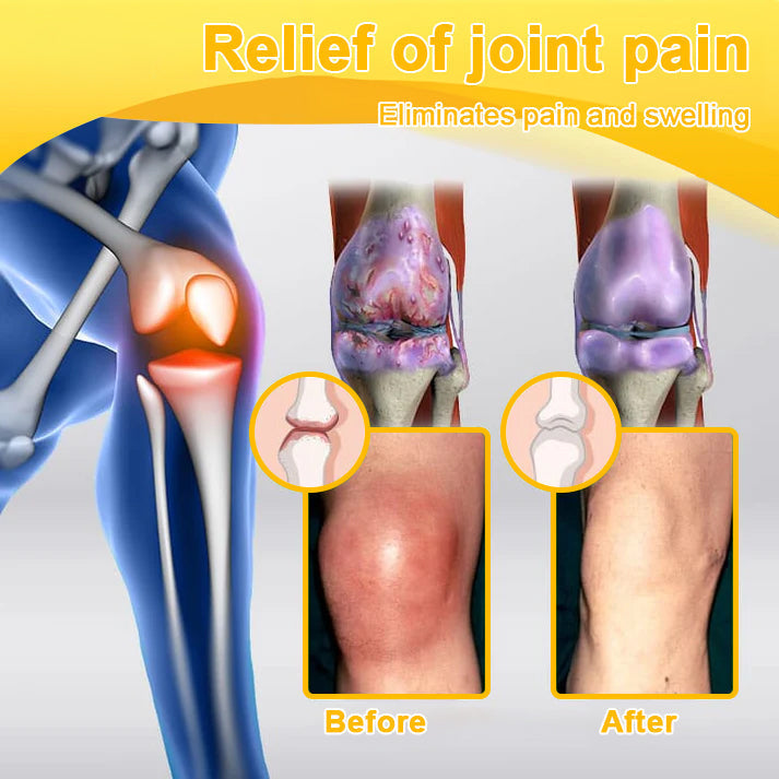 Aeehfeng® Only 8 PCS left! We are offering you an additional 30% OFF! Your orthopedic surgeon recommends that you use 4-5 consecutive PCS to restore your joints to health! If you miss this opportunity, you'll have to wait until next year!